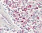 CCR4 Antibody (N-Terminus)